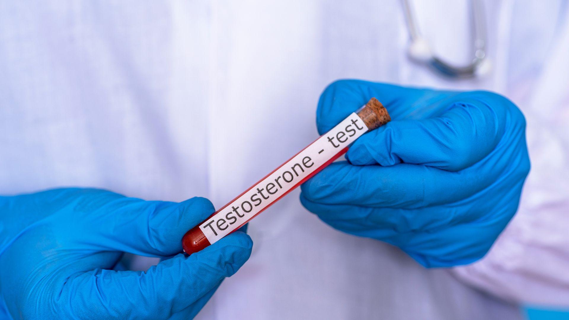 Descubra como a reposição hormonal pode ajudar a tratar baixos níveis de testosterona e melhorar sua qualidade de vida.